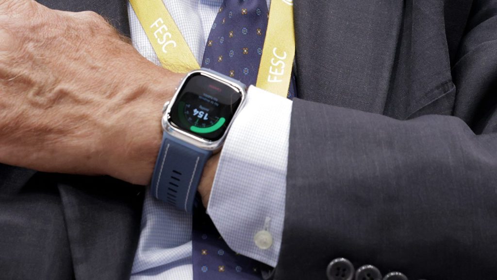 huawei watch d2